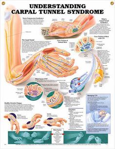 Carpal Tunnel Exercises, Carpal Tunnel Relief, Hand Therapy, Healthy Lifestyle Changes, Carpal Tunnel, Medical Knowledge, Bench Press, Health Info, Occupational Therapy