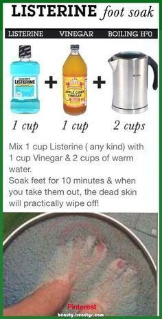 Vinegar Foot Soak, Listerine Foot Soak, Foot Soak Recipe, Foot Soak, Juice Recipes, Skin Care Remedies, Diy Skin