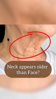 Strivectin Neck Cream Before And After, Exercise For Turkey Neck, Double Neck Exercise, Tone Neck And Chin, Neck Care Anti Aging, Neck Exercises To Tighten Skin, Neck Tightening Procedures, Saggy Neck Skin How To Get Rid, How To Get Rid Of Turkey Neck