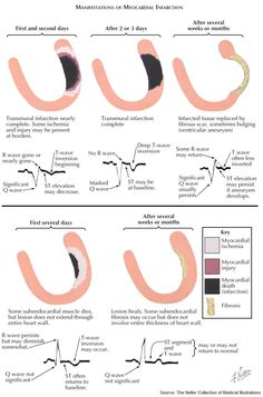 an image of different types of medical instruments and how they are used to treat them