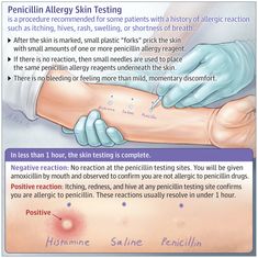 an info poster describing how to treat the skin on someone's arm and foot