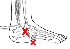 Peroneal Tendon, Ligament Injury, Ankle Pain, Sprained Ankle, Calf Muscles, Foot Health, Foot Pain, Ankle Bones, Health Facts