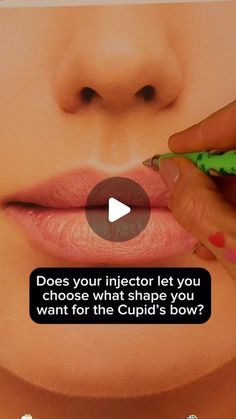 Dr Rebecka Gardell on Instagram: "What shape do you prefer for the Cupid’s bow?" Aesthetic Nursing, Cupids Bow, Nursing Tips, Tips Tricks, Plastic Surgery, Surgery, Nursing, Let It Be, On Instagram