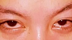 an image of the eyes of a person with contactions on their eyelides