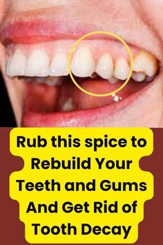 Baking Soda Teeth, Strong Teeth, Healthy Teeth And Gums, Strengthen Teeth, Whitening Teeth, Healthy Gums, Whiter Teeth, Whiten Teeth