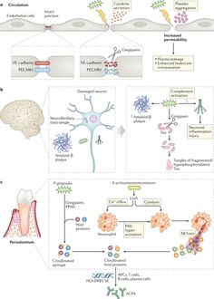 Local and systemic mechanisms linking periodontal disease and inflammatory comorbidities | Nature Reviews Immunology University Of St Andrews, Oral Pathology, Animal Studies, Chronic Inflammation, Autoimmune Disease, Universe