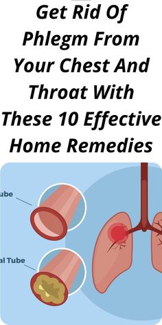 Getting Rid Of Mucus, Chest Congestion Remedies, Getting Rid Of Phlegm, Home Remedies For Bronchitis, Best Cough Remedy, Home Health Remedies