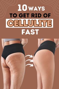 10 Ways To Get Rid Of Cellulite Fast: Cellulite is commonly seen on the thighs, buttocks, hips, and abdomen, and it can make you conscious and hide your beauty behind long pants and tops. Thankfully, there are some effective ways to get rid of cellulite. #cellulite #beauty #beautytips #skincare Tighten Buttocks Exercises, Workouts To Get Rid Of Cellilute Fast, Get Rid Of Cellilute Disease, How To Get Rid Of Leg Cellilute, How To Get Rid Of Cellilute Fast Diy, How To Get Rid Of Cellilute Fast, How To Get Rid Of Cellilute Fast Workout, How To Get Rid Of Back Fat Fast, Tighten Buttocks