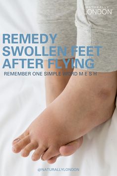 a person holding the foot of another persons hand with text that reads, remedy swollen feet after flying