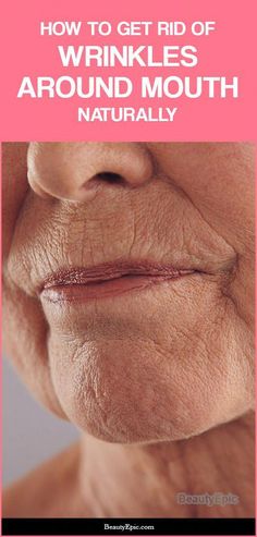 It is easy and inexpensive to reduce and get rid of wrinkles around your mouth. Of course, you have to make a little effort and exercise Natural Wrinkle Remedies, Wrinkles Around Mouth, Face Wrinkle, Home Remedies For Wrinkles, Sagging Cheeks, Wrinkles Remedies Face, Mouth Wrinkles, Wrinkles Remedies, Wrinkle Remedies