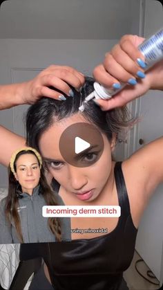 Lindsey Zubritsky, MD, FAAD on Instagram: "Minoxidil is THE most effective OTC hair growth treatment. No question.  But lots of confusion surrounding how to use it, the dread shed, and which one to buy.  Shoutout to @meghaess for being real with this video!  Questions about minoxidil? Ask em below ⬇️" Bob Haircuts For Women, Cornrow Hairstyles, Bobs Haircuts, Haircuts For Men, Hair Growth, New Hair, Mens Hairstyles, Straight Hairstyles, How To Use