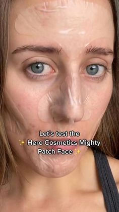 How To Get Rid Of Pimples Fast At Home, Closed Comedones, Painful Pimple, Skin Blackheads, Big Pimple, Mighty Patch, Acne Patches, Acne Patch, Pimple Patches