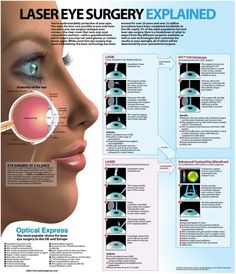 Laser Eye Surgery Explained Logo Eye, Laser Clinics