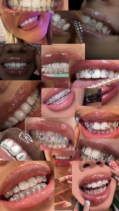 Teeth Gems Diy, Bijoux Piercing Septum, Money Tricks, Trippy Tattoo, Dental Jewelry, Xoxo Jewelry, Diamond Teeth