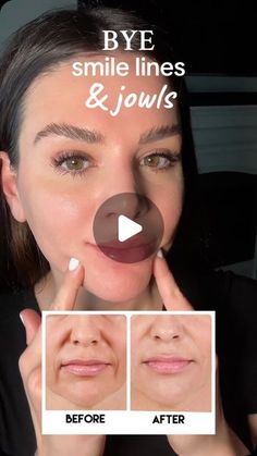 Guasha For Smile Lines, Gua Sha Jowls, Gua Sha For Smile Lines, Gua Sha Smile Lines, Gua Sha For Jowls, How To Reduce Smile Lines, Reduce Jowls, Guasha Tutorial, Facial Exercises For Jowls