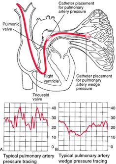 an image of the heart and its valves with red lines going through it, as well as other diagrams