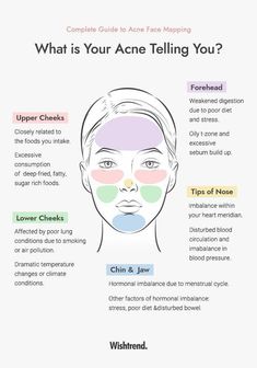 What Different Areas Of Acne Mean, Reasons Why You Have Acne, What Does Acne On Your Forehead Mean, Placement Of Pimples Meaning, What Does Ur Acne Mean, What My Acne Is Telling Me, Skin Breakout Chart, Why Acne Is Where It Is, What Is Causing My Acne