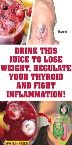 The Relationship Between Thyroid Health and Weight Loss Joints Pain Remedy, Thyroid Gland, Juicing For Health, Joints Pain Relief, Thyroid Health, Weight Tips, Healthy Juices, About Women, Health Info