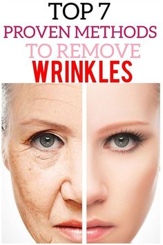 PROVEN METHOD TO REMOVE WRINKLES Skincare Basic, Remove Age Spots, Skincare Routine Clear Skin, Basic Skincare Routine, Basic Skincare, Get Clear Skin, Pimples Overnight