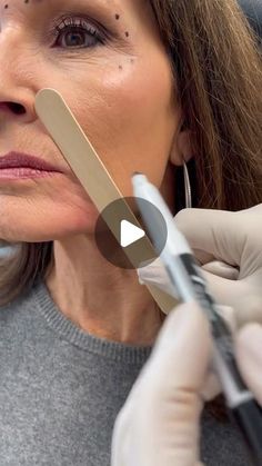 Lip Flip Vs Filler, Frown Lines Around Mouth, Galderma Aesthetics, Botox Around Mouth, Marionette Lines Filler, Lip Line Filler, Botox Business, Facial Muscles Anatomy, Upper Lip Wrinkles