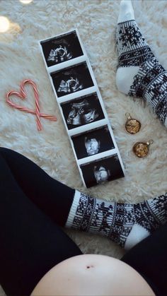 a pregnant woman's legs and socks are shown next to an assortment of candies