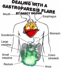 Gastric Problem, Gastrointestinal Disease, Reflux Symptoms, Acid Reflux, Autoimmune Disease, Air Fryer, Disease, Medical, Human