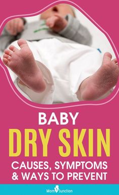 baby dry skin cause, symptoms and ways to prevent it from being sick