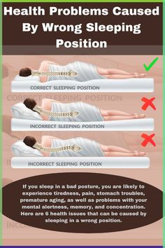 If you sleep in a bad posture, you are likely to experience tiredness, pain, stomach troubles, premature aging, as well as problems with your mental alertness, memory, and concentration. Here are 6 health issues that can be caused by sleeping in a wrong position. Constant Headaches, Magnesium Benefits, Health Podcast, Learn Yoga, Bad Posture, Pregnant Diet