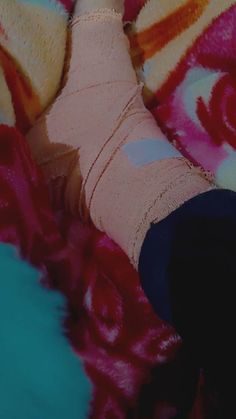 a person with a cast on their leg and foot in a bed covered in blankets