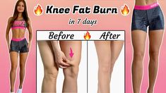 KNEE FAT BURN WORKOUT 🔥 Get TONED Model Legs in Just 5 min Daily 🔥 No Squats, No Jumping - YouTube Knee And Thigh Exercises, Knee Toning Exercises, Knee Tightening Exercises, Toned Knees Workout, How To Slim Knees, Inner Knee Workout