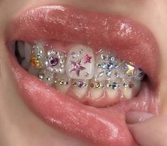 a close up of a person's mouth with different colored stones on the teeth