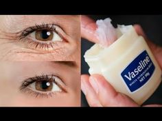 Remove Under Eye Bags, Puffy Eyes Remedy, Obličejové Masky, Wrinkle Remedies, Under Eye Wrinkles, Remove Dark Circles, Skin Care Wrinkles, Face Wrinkles