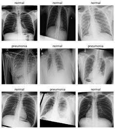 the chest and chest are shown with different types of lunges in each section, including an x - ray