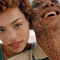 an older man with freckles on his face next to a young woman's head