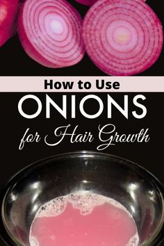 Onions For Hair Growth, Hair Growth Drops, Black Women Hair Growth, Onion Hair Growth, For Fast Hair Growth, Onion Juice For Hair, Fast Hair Growth, Onion For Hair, Onion Juice