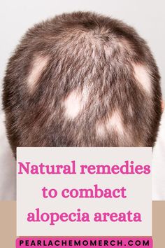 In this video you will learn natural remedies and tips for treating alopecia areata. I delve into the strategies used by people worldwide to combact alopecia.
Click the link below to learn more. Hair Regrowth Tips, Hair Regrowth, The Natural, Natural Remedies, Click The Link, Talk About, To Learn