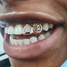 a close up of a man's teeth with braces and gold earring