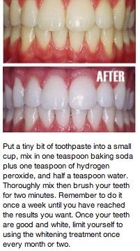 You could try this method, but don't swallow the hydrogen peroxide (these results might be exaggerated) or you could come in and pay a one time fee and sign up for our Nice and Bright Teeth Whitening program for life! Diy Teeth, Teeth Whitening Remedies, Teeth Whitening Diy, Diy Teething, Oral Care Routine, Natural Teeth Whitening, Natural Teeth, Oral Health Care, Tooth Decay