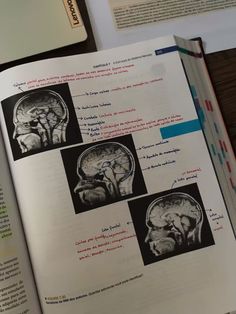 an open book with pictures of the human brain