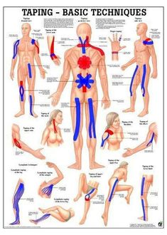 Kt Tape Volleyball, Human Muscular System, Fitness Poster, Volleyball Practice, Yoga Online, Muscular System