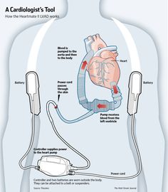 the heart is connected to an electric device