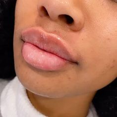 a close up of a woman's face with freckles on her lips