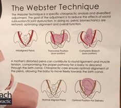 Misaligned Pelvis, Webster Technique, Chiropractic Quotes, Chiropractic Marketing, Physical Therapy School, Chiropractic Clinic, Pregnancy Must Haves, Naturopathic Medicine