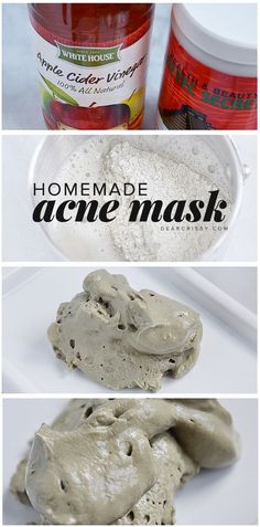 Homemade Acne Mask - This DIY acne mask recipe has just two ingredients and will detoxify your skin while unclogging and shrinking pores. AMAZING homemade beauty solution. Homemade Acne Mask, Diy Acne Mask, Big Muscle, Crochet Cowls, Arabic Recipes, Rock Clothing, Acne Mask, Diy Acne, Lace Diy