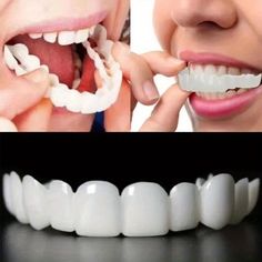 Profitez de la livraison et du retour gratuits pour les nouveaux utilisateurs Teeth Covers, Temporary Tooth, Fake Teeth, Dental Veneers, Dental Cosmetics, Decoration Accessories, Oral Care, Body Jewelry, Easy To Use