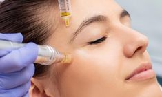 Beauty Salon Aesthetic, Microneedling With Prp, Under Eye Dark Circles, Prp Therapy, Anti Wrinkle Injections, Micro Needling, Derma Pen, Cosmetic Injectables, North Sydney