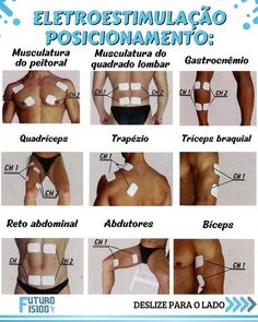 Tens Unit Placement, Physical Therapy Student, Medicine Studies, Kinesio Taping, Lymph Massage, Physiotherapy Clinic, Physical Therapy Exercises, Ten Unit, Anatomy Study