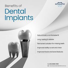 🦷 Ready to transform your smile? Discover the incredible benefits of dental implants:  1️⃣ Natural Look & Comfortable Fit 2️⃣ Long Lasting & Reliable 3️⃣ Permanent Solution For Missing Teeth 4️⃣ Improved Ability to Eat & Chew 5️⃣ Improved Facial and Bone Features   Regain your smile and confidence with dental implants! Schedule your consultation today.  #DentalImplants #SmileTransformation #ConfidentSmile #DentalHealth #SmileMakeover #ImplantDentistry #HealthyTeeth #CosmeticDentistry Dental Cabinet, Dental Fillings, Dental Emergency, Dental Marketing, Dental Kids