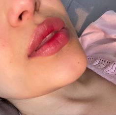 Lip Filler No Cupids Bow, Plump Lips Naturally Aesthetic, V Shaped Chin, Korean Lip Filler, Plump Lips Aesthetic, Lip Filler Natural, Natural Lip Fillers, Lip Goals