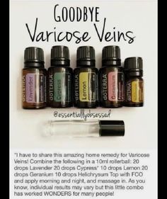 Essential Oils For Varicose Veins, Varicose Veins Essential Oils, Doterra Oils Recipes, Varicose Vein Remedy, Doterra Recipes, Roller Blends, Doterra Essential Oils Recipes, Essential Oil Remedy, Doterra Oil